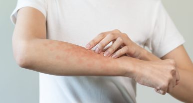 alergia-sistema-inmune-anticuerpos